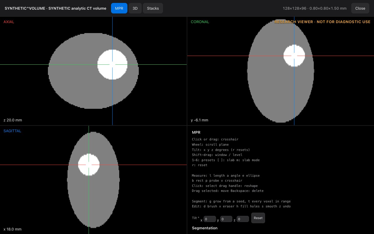 MPR: three linked planes through the phantom's sphere